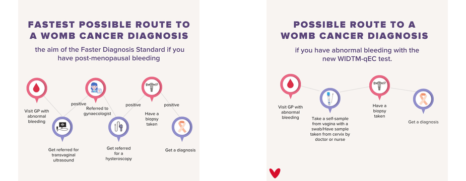 a timeline chart with the title: fastest possible route to womb cancer diagnosis. It shows: GP appointment, referral for ultrasound, referral to gynaecologist, hysteroscopy/biopsy, then result

a timeline chart with title: possible route to diagnosis with new WID-EC test: GP appointment, self-sampled swab or cervical sample taken from nurse/GP, biopsy, result