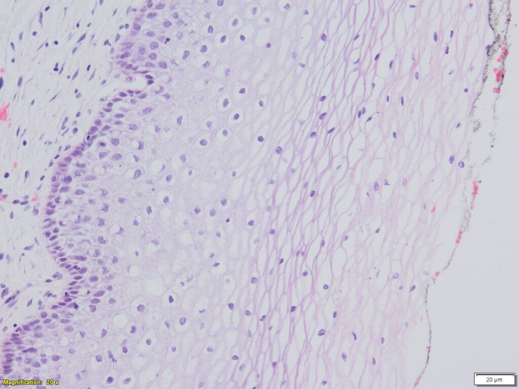 A sample of a healthy cervix under a microscope