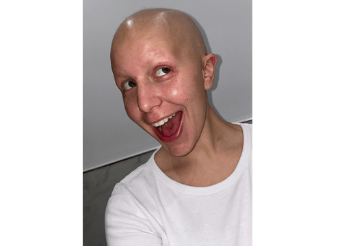 Photo of Daniella smiling, she has no hair in this photo due to chemo